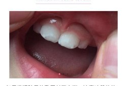 孕妇吃什么胎儿会白（宝宝牙齿有白斑怎么回事？白斑是什么原因引起的呢）