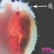 胎儿绒毛组织（胎儿绒毛组织是什么）