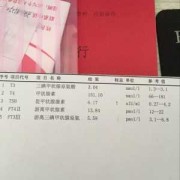 孕期ft3偏低（孕期ft3偏低其他正常）