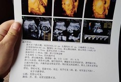 胎儿系统超声检查是检查什么的,胎儿心脏超声筛查是四维吗