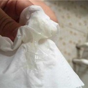 孕期白带多发黄怎么办（黄白带多怎么调理）