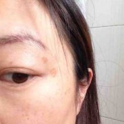 孕期长斑点（孕期长斑点是怎么回事）