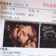 33周小朋友一般多重,33周胎儿多重正常