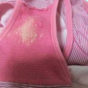 孕期白带黄绿色豆腐渣（孕期分泌物黄绿色豆腐渣）