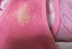 孕期白带黄绿色豆腐渣（孕期分泌物黄绿色豆腐渣）