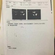 b超mi是什么意思,胎儿b超指数参考
