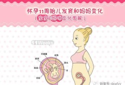 孕期示意图（孕妇示意图）