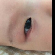 7个半月胎儿图片（7个月宝宝眼睛周围总起红疙瘩是怎么了）