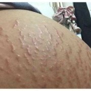 孕期没反应正常吗（怀孕第12周忽然没什么妊娠反应了正常吗）