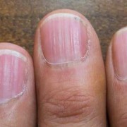 4个月的宝宝指甲有竖纹怎么回事,怀孕4个半月胎儿在小腹下面