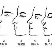 婴儿鼻型如何判断鼻梁高,胎儿鼻子高是男孩女孩