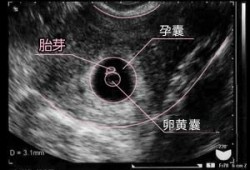 胎芽回声是什么意思,胎儿和胎芽的区别
