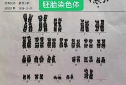 胎儿染色体检查怎么做,验胎儿染色体多少钱