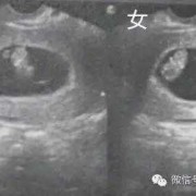 怀孕鉴定胎儿性别（怀孕鉴定胎儿性别准吗）