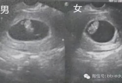 怀孕鉴定胎儿性别（怀孕鉴定胎儿性别准吗）