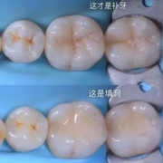 怀孕期间能不能补牙（怀孕期间能不能补牙洞）