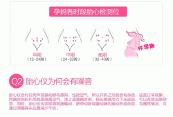 胎儿心率仪（胎儿心率仪怎么用）
