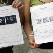 胎儿偏左侧是什么原因（怀孕七个月了，胎儿总在左边动，右边不动，是什么原因呢）