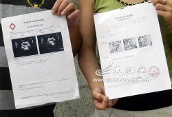 胎儿偏左侧是什么原因（怀孕七个月了，胎儿总在左边动，右边不动，是什么原因呢）