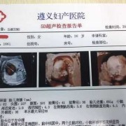胎儿5d彩超图片（临汾有5d彩超么）
