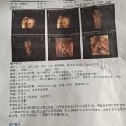 胎儿4个月4维彩超图（4维彩超多少钱）