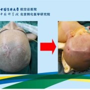 胎儿脑部积水（胎儿脑部积水是怎么引起的）