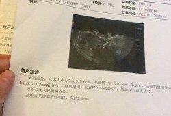 孕期查出子宫肌瘤（孕期查出子宫肌瘤要紧吗）