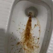 孕期胃出血（孕期胃出血怎么办）