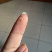 孕期乳头里面脏东西要怎么清理,