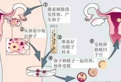 试管婴儿孕期（试管婴儿孕期）