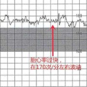 胎心监护多少分正常,