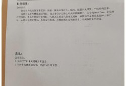 27周胎儿头围标准（2021年11月27号对应的新历是）