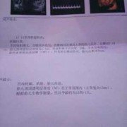 孕12周胎心167次正常吗,胎儿心跳167正常吗