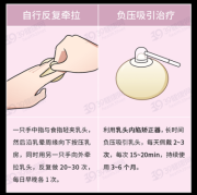 乳头内陷孕期怎么治疗（乳头内陷孕期怎么治疗好）