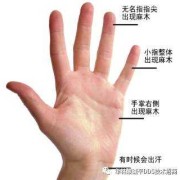 孕晚期右手指尖麻，正常吗?以前都是晚上睡觉时会麻,怀孕期间右手麻木是什么原因