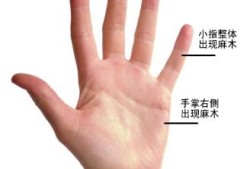 孕晚期右手指尖麻，正常吗?以前都是晚上睡觉时会麻,怀孕期间右手麻木是什么原因