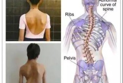 胎儿脊椎低（孕16周B超单显示脊椎骶尾部显示不清，余大致正常？有关系吗）