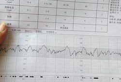做胎监的时候宝宝一直动，胎心率很高，要不要紧呢,胎监胎儿动了为什么还不合格