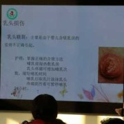 怀孕乳头变黑怎么办,孕期乳头发黑什么原因