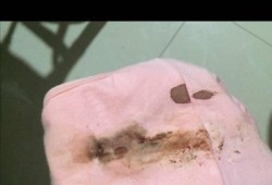 孕期下面流血（孕期下面流血是什么情况）