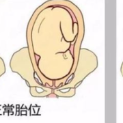胎儿双顶径96能顺产吗（胎儿双顶径96能顺产吗视频）