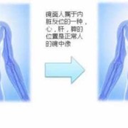 镜子宝宝是什么意思,胎儿镜面人是什么意思
