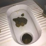 在备孕期间拉稀拉水了该怎么办,备孕期间拉肚子怎么办
