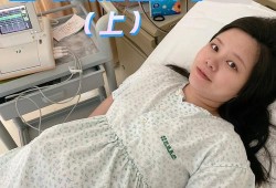 38周剖腹产对胎儿有影响吗（38周剖腹产对胎儿有影响吗会不会引起黄胆）