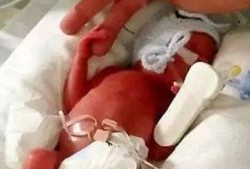 怀孕20周了能做人流吗,孕2o周胎儿样子图片