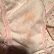 孕期褐色分泌物图片（怀孕差不多三个月，内裤突然出现棕褐色分泌物，是怎么回事）