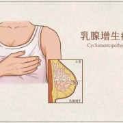 孕期乳房胀痛有硬块（哺乳期乳房里有硬块是怎么回事）