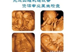 孕期为什么要做两次四维（孕期为什么要做两次四维）