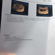 胎儿头圆还是椭圆好（胎儿头圆还是椭圆好看）