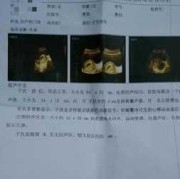 为什么b超单怀孕周数比实际小一周多呢,孕期比超单CC和CM是不一样吗